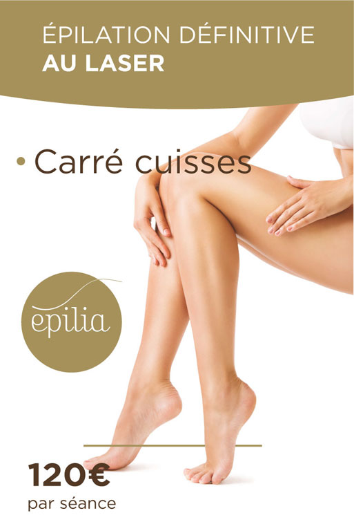 epilation-laser-carre-cuisses-esch-sur-alzette-mob