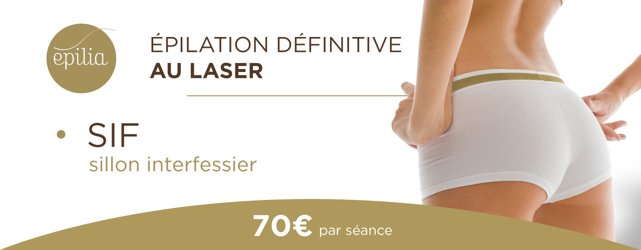 epilation-laser-sif-esch-sur-alzette