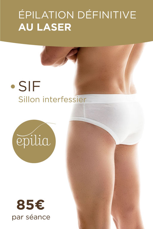 epilation-laser-sif-homme-esch-sur-alzette-mob